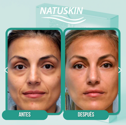 Parches de Colágeno Natuskin ✨Colágeno que hidrata y cuida tu Piel